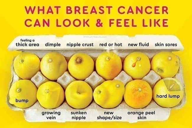 breast cancer - what it can look like